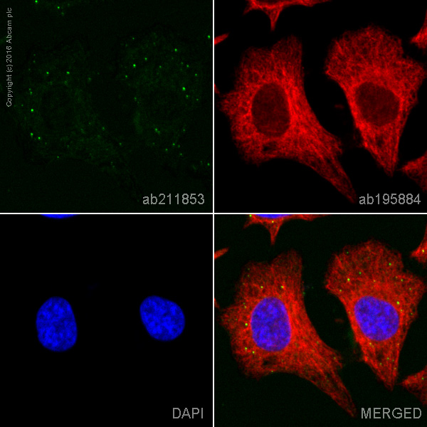Immunocytochemistry/ Immunofluorescence - Alexa Fluor® 555 Anti-Dcp1a antibody [EPR13822] (AB211853), expandable thumbnail