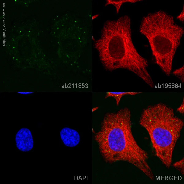 Immunocytochemistry/ Immunofluorescence - Alexa Fluor® 555 Anti-Dcp1a antibody [EPR13822] (AB211853)