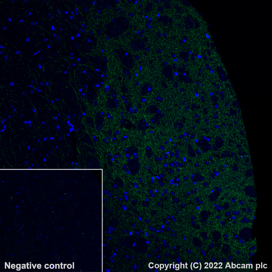 Immunohistochemistry - Alexa Fluor® 555 Anti-Dopamine Transporter antibody [EPR19695] (AB302551), expandable thumbnail