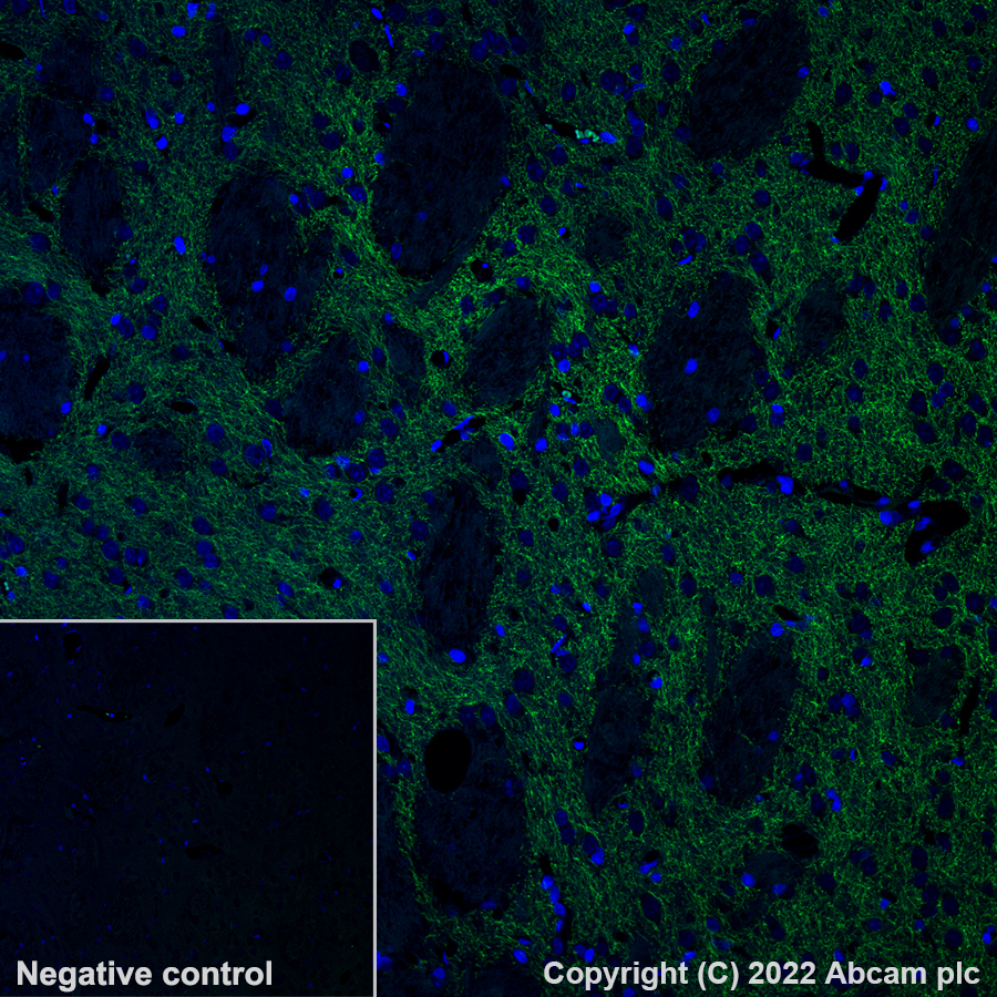 Immunohistochemistry - Alexa Fluor® 555 Anti-Dopamine Transporter antibody [EPR19695] (AB302551), expandable thumbnail