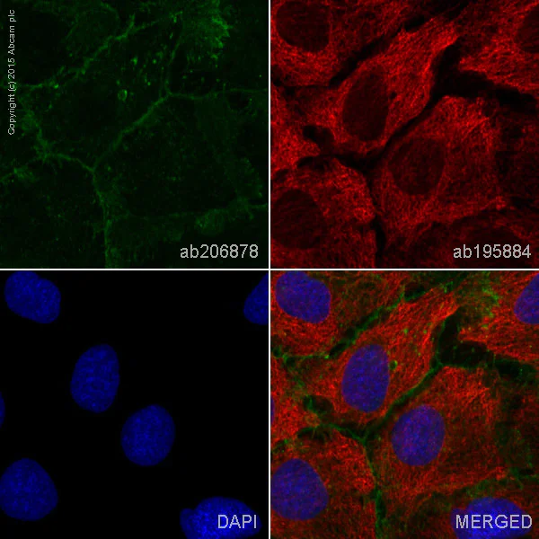 Immunocytochemistry/ Immunofluorescence - Alexa Fluor® 555 Anti-E Cadherin antibody [EP700Y] - Intercellular Junction Marker (AB206878)