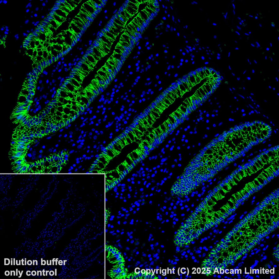 Immunohistochemistry (Formalin/PFA-fixed paraffin-embedded sections) - Alexa Fluor® 555 Anti-E Cadherin antibody [EP700Y] - Intercellular Junction Marker (AB206878)