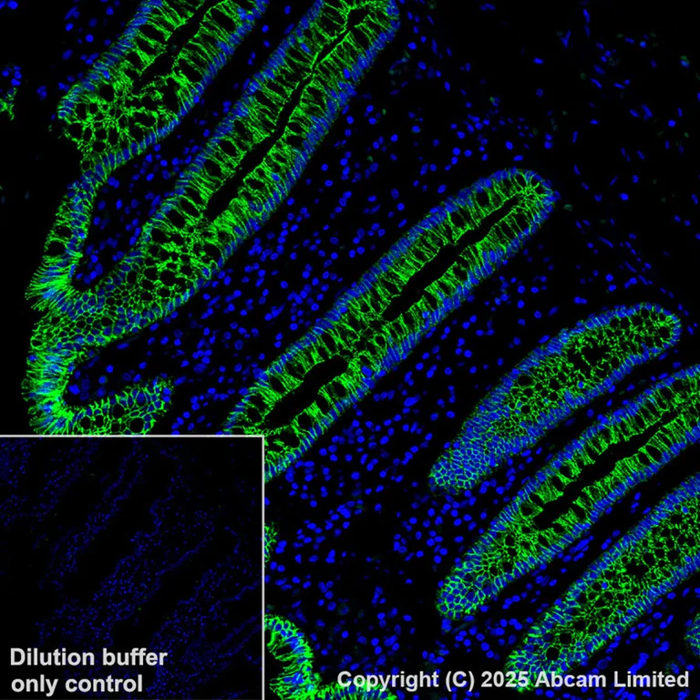 Immunohistochemistry (Formalin/PFA-fixed paraffin-embedded sections) - Alexa Fluor® 555 Anti-E Cadherin antibody [EP700Y] - Intercellular Junction Marker (AB206878)