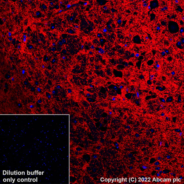 Immunohistochemistry (Formalin/PFA-fixed paraffin-embedded sections) - Alexa Fluor® 555 Anti-EAAT2 antibody [EPR19798] (AB313819)