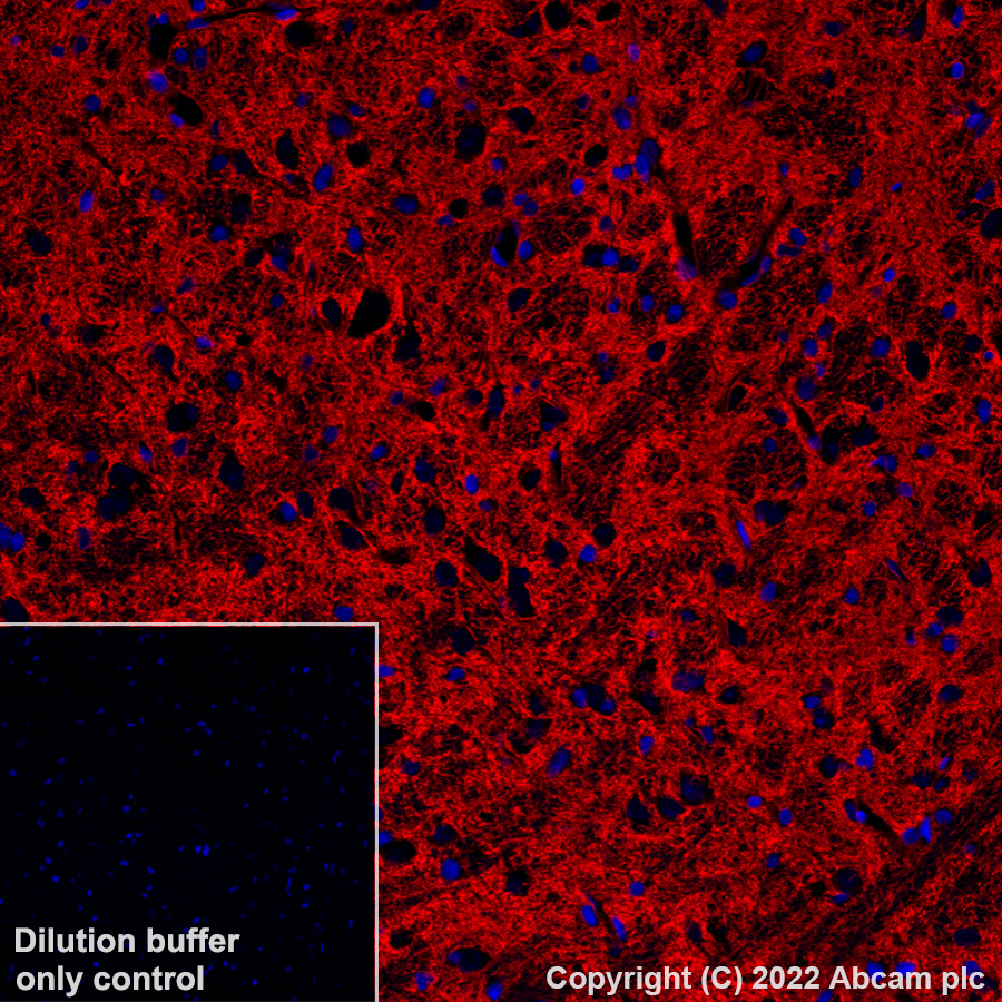 Immunohistochemistry (Formalin/PFA-fixed paraffin-embedded sections) - Alexa Fluor® 555 Anti-EAAT2 antibody [EPR19798] (AB313819), expandable thumbnail