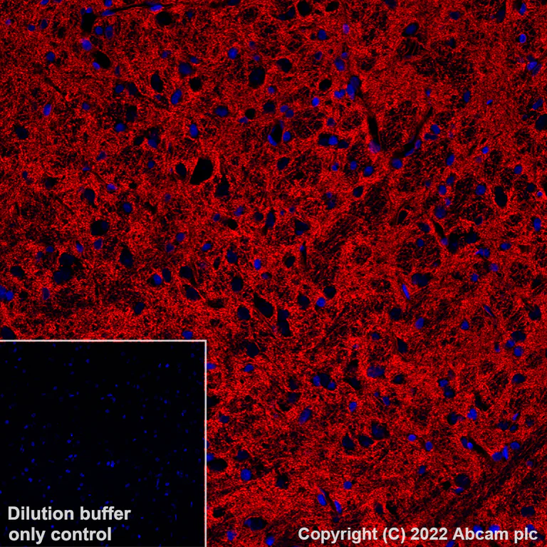 Immunohistochemistry (Formalin/PFA-fixed paraffin-embedded sections) - Alexa Fluor® 555 Anti-EAAT2 antibody [EPR19798] (AB313819)