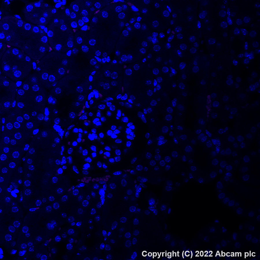Immunohistochemistry (Formalin/PFA-fixed paraffin-embedded sections) - Alexa Fluor® 555 Anti-EAAT2 antibody [EPR19798] (AB313819), expandable thumbnail