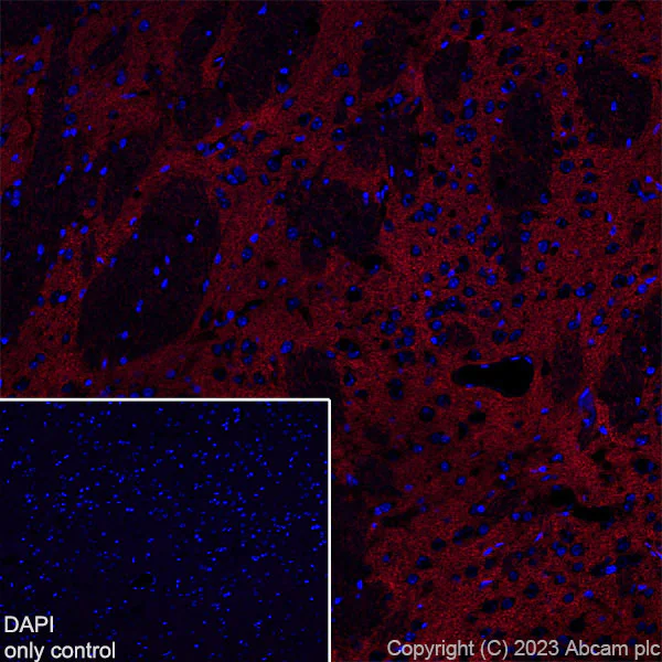 Immunohistochemistry (Frozen sections) - Alexa Fluor® 555 Anti-EAAT2 antibody [EPR19798] (AB313819)