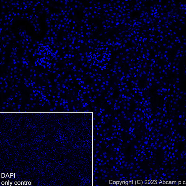 Immunohistochemistry (Frozen sections) - Alexa Fluor® 555 Anti-EAAT2 antibody [EPR19798] (AB313819), expandable thumbnail