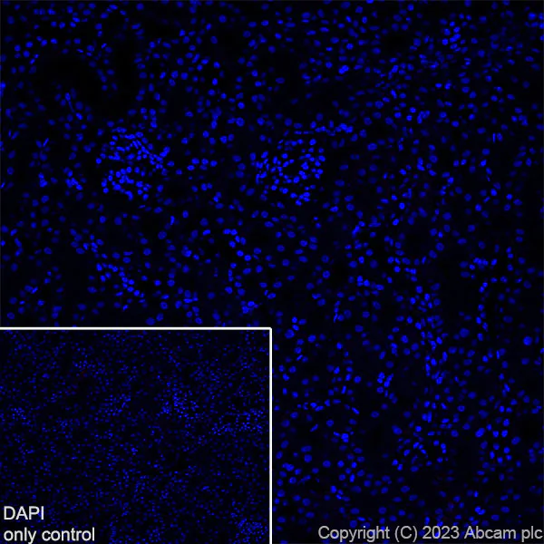 Immunohistochemistry (Frozen sections) - Alexa Fluor® 555 Anti-EAAT2 antibody [EPR19798] (AB313819)