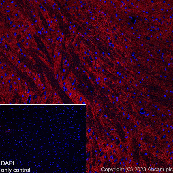 Immunohistochemistry (Frozen sections) - Alexa Fluor® 555 Anti-EAAT2 antibody [EPR19798] (AB313819)