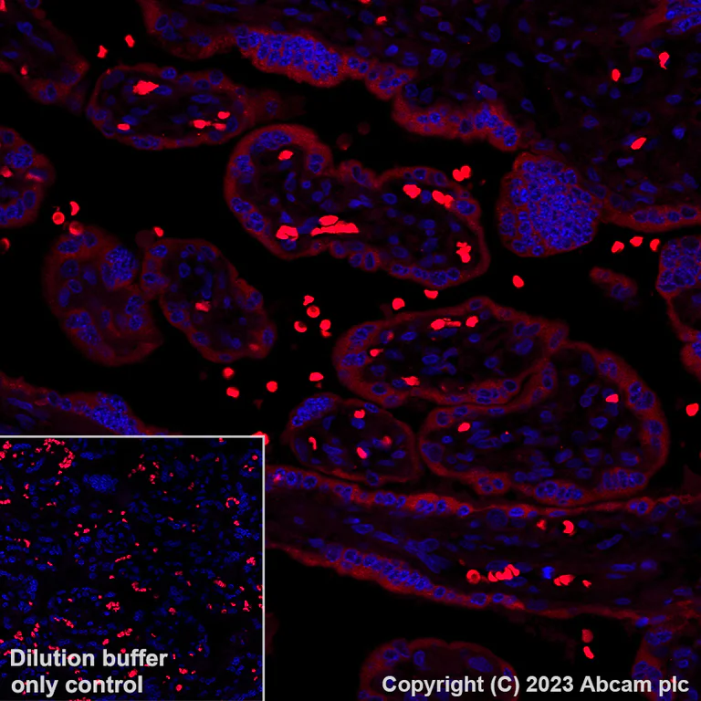 Immunohistochemistry (Formalin/PFA-fixed paraffin-embedded sections) - Alexa Fluor® 555 Anti-EBI3 antibody [EPR25341-155] (AB314592)