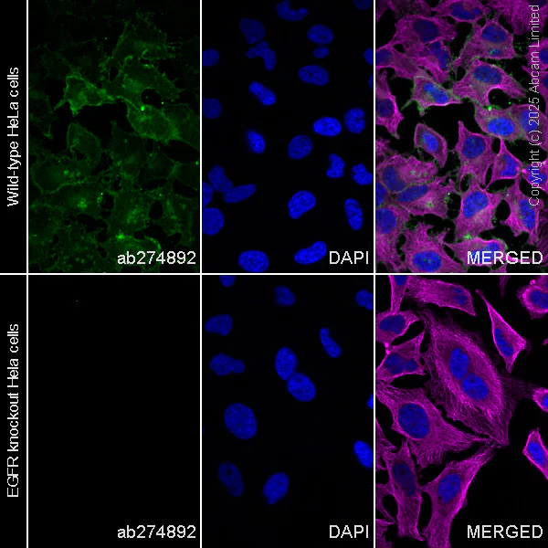 Immunocytochemistry/ Immunofluorescence - Alexa Fluor® 555 Anti-EGFR antibody [EP38Y] (AB274892)