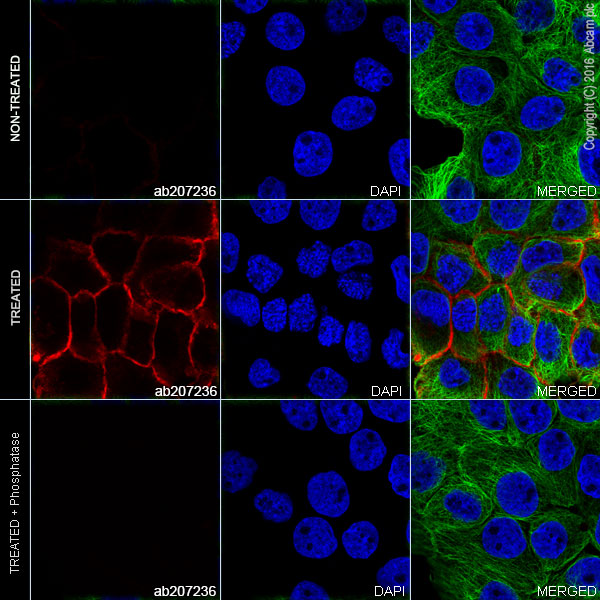 Immunocytochemistry/ Immunofluorescence - Alexa Fluor® 555 Anti-EGFR (phospho Y1173) antibody [E124] (AB207236), expandable thumbnail