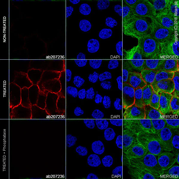 Immunocytochemistry/ Immunofluorescence - Alexa Fluor® 555 Anti-EGFR (phospho Y1173) antibody [E124] (AB207236)