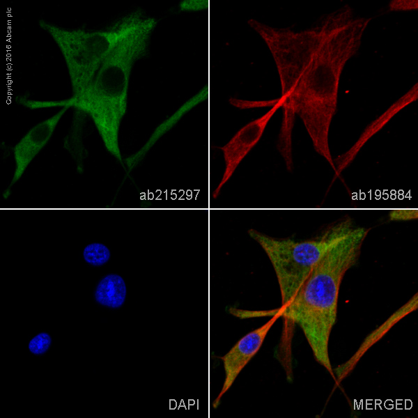 Immunocytochemistry/ Immunofluorescence - Alexa Fluor® 555 Anti-ENO1 + ENO2 + ENO3 antibody [EPR3377] - Neuronal Marker (AB215297)