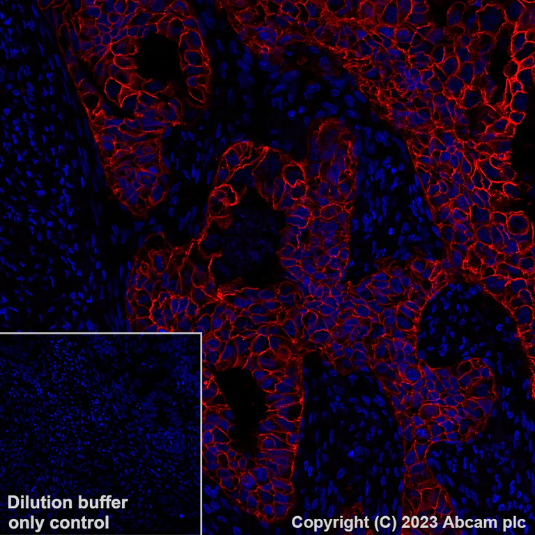 Immunohistochemistry (Formalin/PFA-fixed paraffin-embedded sections) - Alexa Fluor® 555 Anti-EpCAM antibody [EPR20532-222] (AB313668)