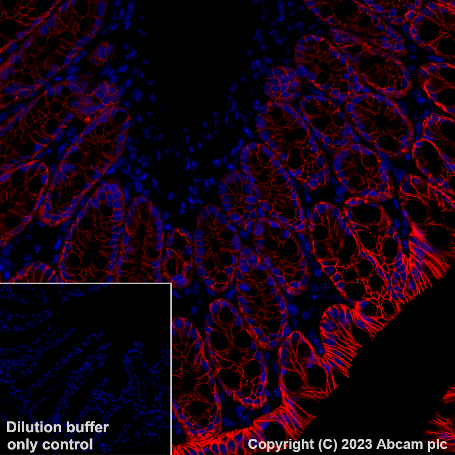 Alexa Fluor® 555 Anti-EpCAM antibody [EPR20532-222] (ab313668) | Abcam
