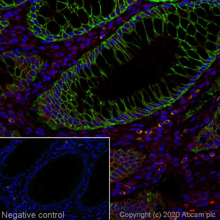 Immunohistochemistry (Formalin/PFA-fixed paraffin-embedded sections) - Alexa Fluor® 555 Anti-EpCAM antibody [EPR677(2)] (AB275122)
