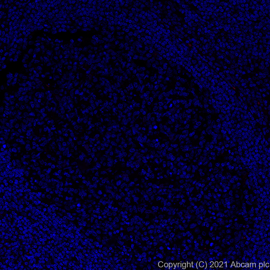 Immunohistochemistry (Formalin/PFA-fixed paraffin-embedded sections) - Alexa Fluor® 555 Anti-ErbB2 / HER2 antibody [EP1045Y] (AB281782), expandable thumbnail