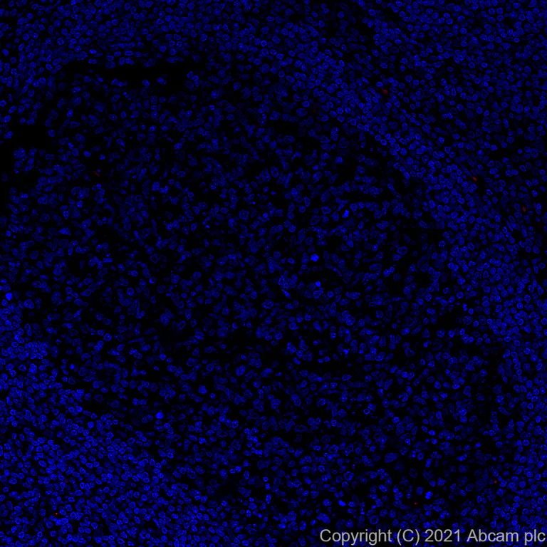Immunohistochemistry (Formalin/PFA-fixed paraffin-embedded sections) - Alexa Fluor® 555 Anti-ErbB2 / HER2 antibody [EP1045Y] (AB281782)