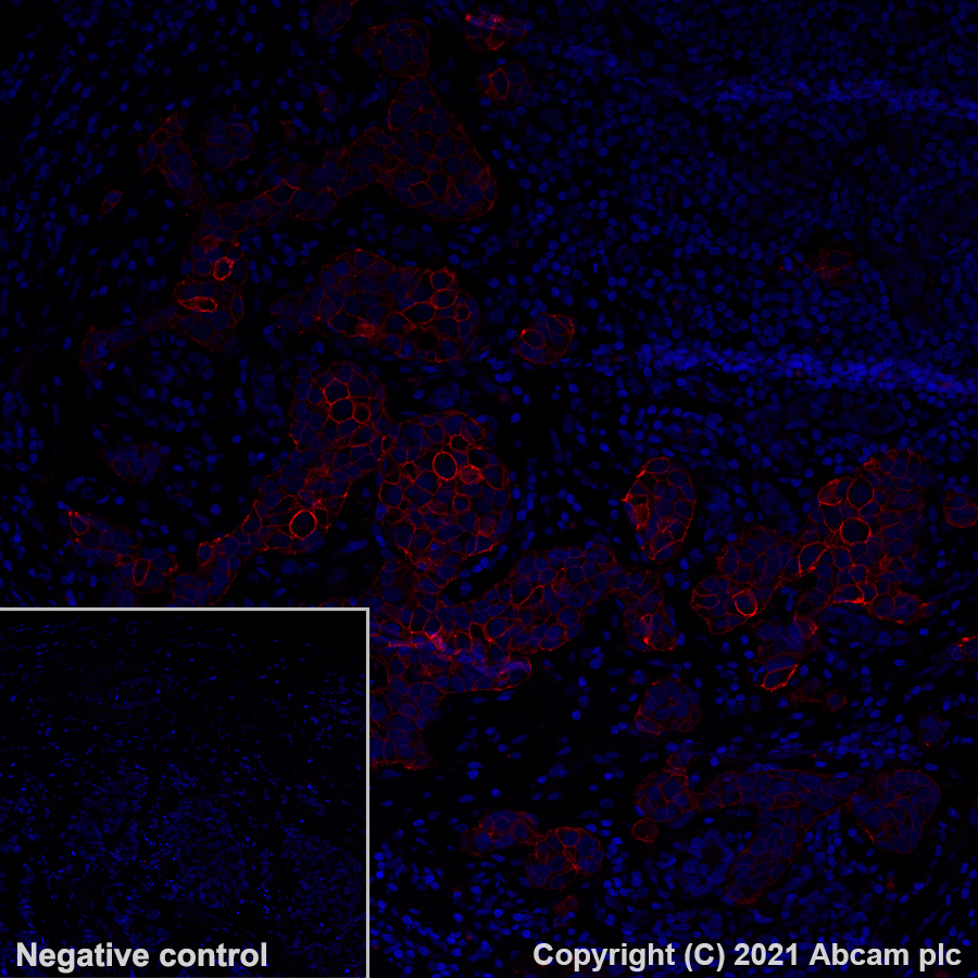 Immunohistochemistry (Formalin/PFA-fixed paraffin-embedded sections) - Alexa Fluor® 555 Anti-ErbB2 / HER2 antibody [EP1045Y] (AB281782), expandable thumbnail