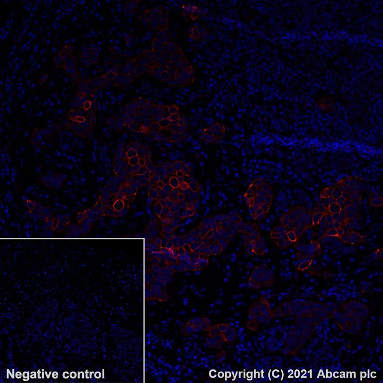 Immunohistochemistry (Formalin/PFA-fixed paraffin-embedded sections) - Alexa Fluor® 555 Anti-ErbB2 / HER2 antibody [EP1045Y] (AB281782)