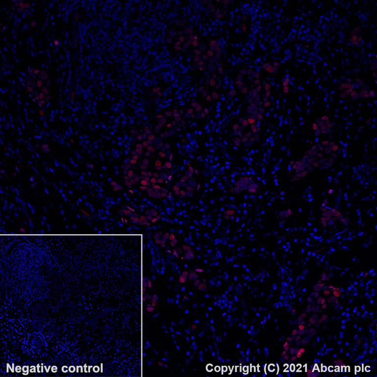 Immunohistochemistry (Formalin/PFA-fixed paraffin-embedded sections) - Alexa Fluor® 555 Anti-Estrogen Receptor alpha antibody [SP1] (AB282199)