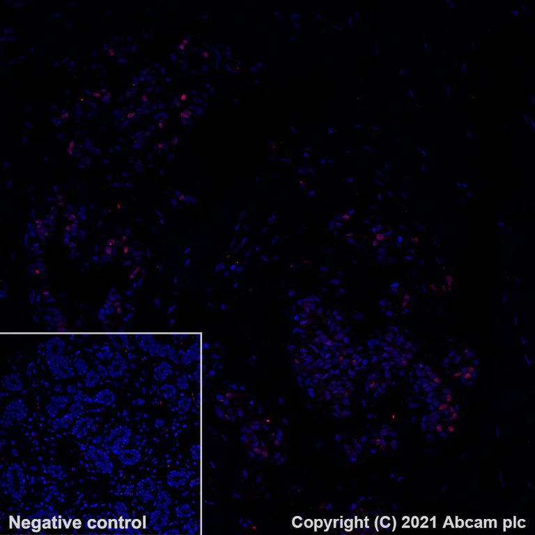 Immunohistochemistry (Formalin/PFA-fixed paraffin-embedded sections) - Alexa Fluor® 555 Anti-Estrogen Receptor alpha antibody [SP1] (AB282199)