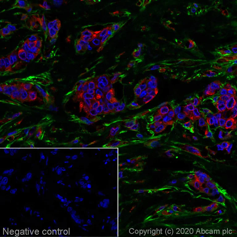 Immunohistochemistry (Formalin/PFA-fixed paraffin-embedded sections) - Alexa Fluor® 555 Anti-Fibronectin antibody [F1] (AB275110)