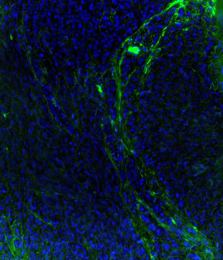 Immunohistochemistry (Formalin/PFA-fixed paraffin-embedded sections) - Alexa Fluor® 555 Anti-Fibronectin antibody [F1] (AB275110)