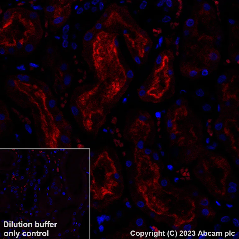 Immunohistochemistry (Formalin/PFA-fixed paraffin-embedded sections) - Alexa Fluor® 555 Anti-Folate Binding Protein/FBP antibody [EPR20277] (AB309247)