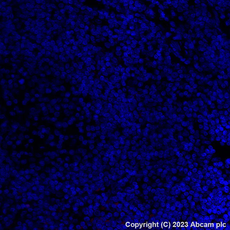Immunohistochemistry (Formalin/PFA-fixed paraffin-embedded sections) - Alexa Fluor® 555 Anti-Folate Binding Protein/FBP antibody [EPR20277] (AB309247)