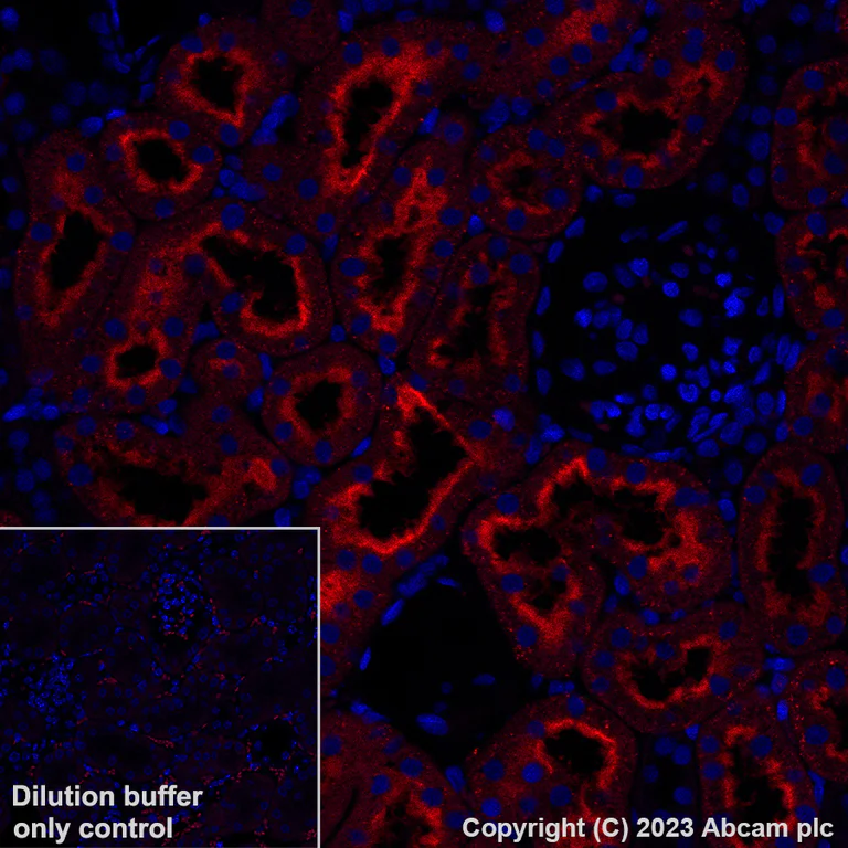 Immunohistochemistry (Formalin/PFA-fixed paraffin-embedded sections) - Alexa Fluor® 555 Anti-Folate Binding Protein/FBP antibody [EPR20277] (AB309247)