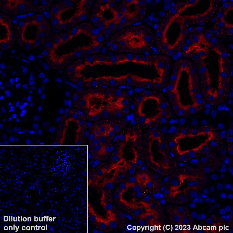 Immunohistochemistry (Formalin/PFA-fixed paraffin-embedded sections) - Alexa Fluor® 555 Anti-Folate Binding Protein/FBP antibody [EPR20277] (AB309247)