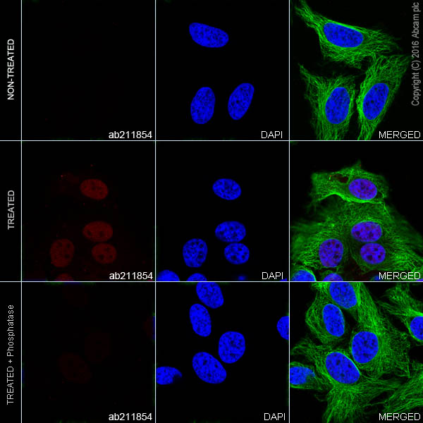 Immunocytochemistry/ Immunofluorescence - Alexa Fluor® 555 Anti-Fos B antibody [EPR15905] (AB211854), expandable thumbnail