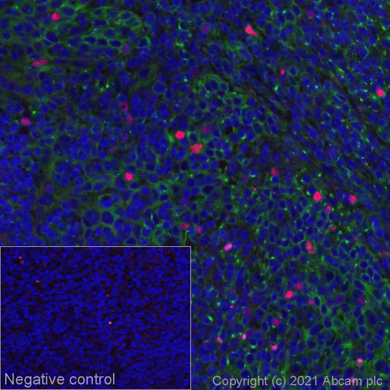 Immunohistochemistry (Formalin/PFA-fixed paraffin-embedded sections) - Alexa Fluor® 555 Anti-FOXP3 antibody [SP97] (AB275120)
