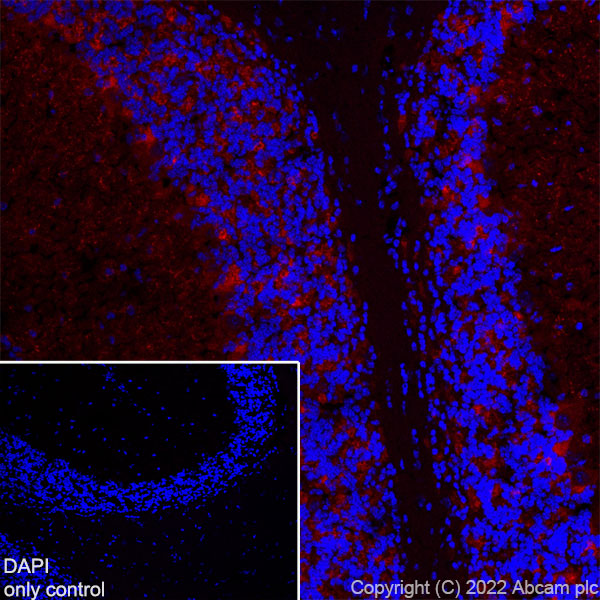 Immunohistochemistry (Frozen sections) - Alexa Fluor® 555 Anti-GAD65 antibody [EPR22952-70] (AB300548)