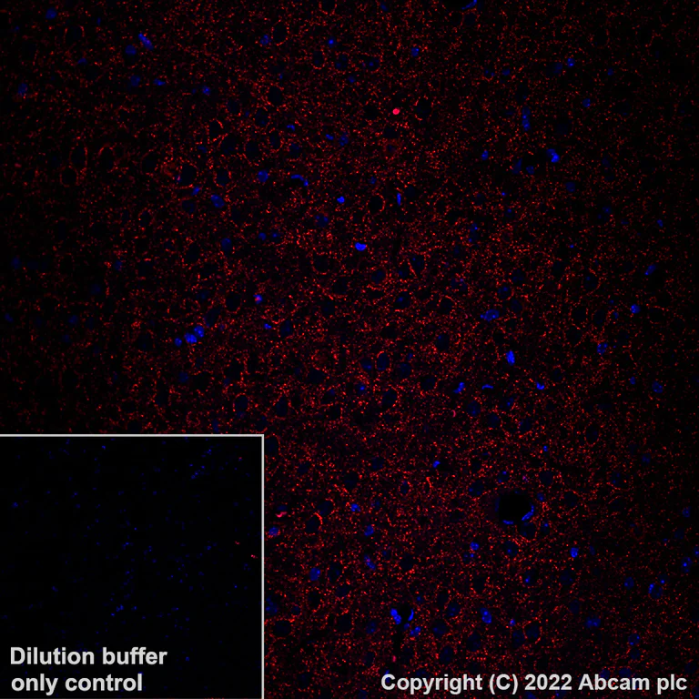 Immunohistochemistry (Formalin/PFA-fixed paraffin-embedded sections) - Alexa Fluor® 555 Anti-GAD67/GAD1 antibody [EPR20578] (AB306572)