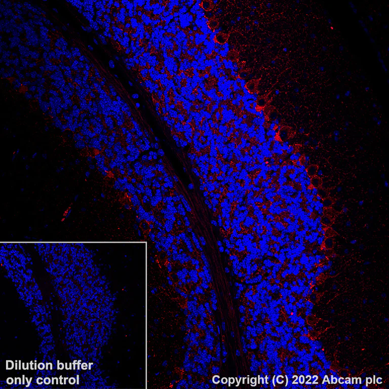 Immunohistochemistry (Formalin/PFA-fixed paraffin-embedded sections) - Alexa Fluor® 555 Anti-GAD67/GAD1 antibody [EPR20578] (AB306572)