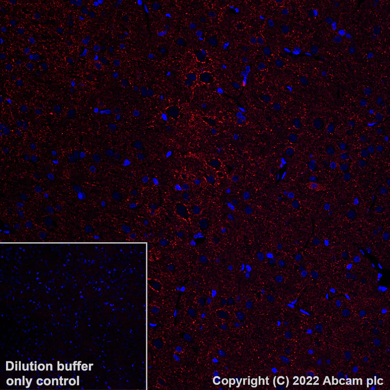 Immunohistochemistry (Formalin/PFA-fixed paraffin-embedded sections) - Alexa Fluor® 555 Anti-GAD67/GAD1 antibody [EPR20578] (AB306572)