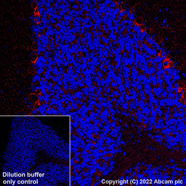 Immunohistochemistry (Formalin/PFA-fixed paraffin-embedded sections) - Alexa Fluor® 555 Anti-GAD67/GAD1 antibody [EPR20578] (AB306572)