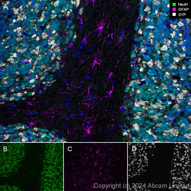 Immunohistochemistry (Formalin/PFA-fixed paraffin-embedded sections) - Alexa Fluor® 555 Anti-GFAP antibody [EPR1034Y] - Astrocyte Marker (AB201735)