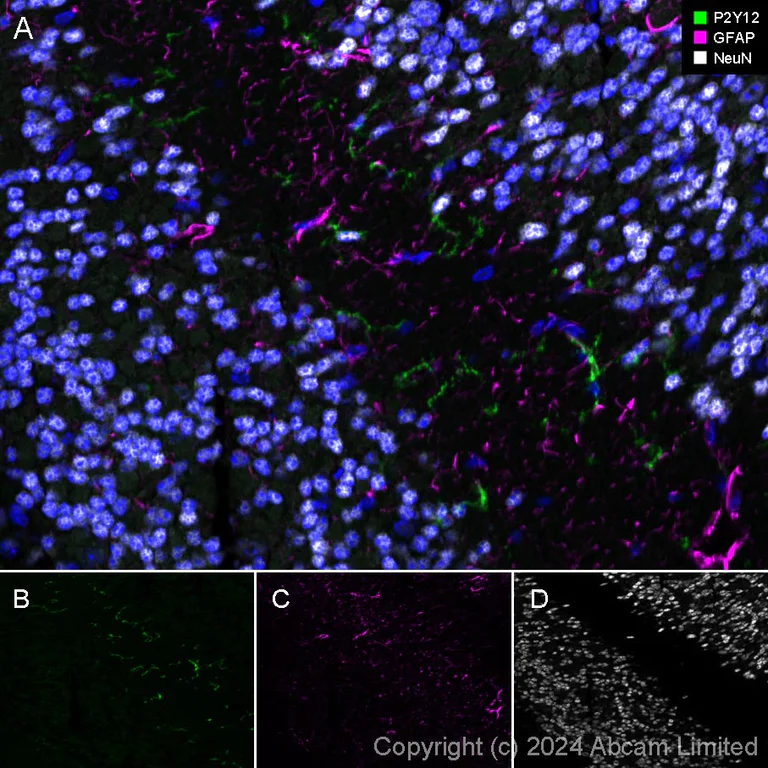 Immunohistochemistry (Frozen sections) - Alexa Fluor® 555 Anti-GFAP antibody [EPR1034Y] - Astrocyte Marker (AB201735)