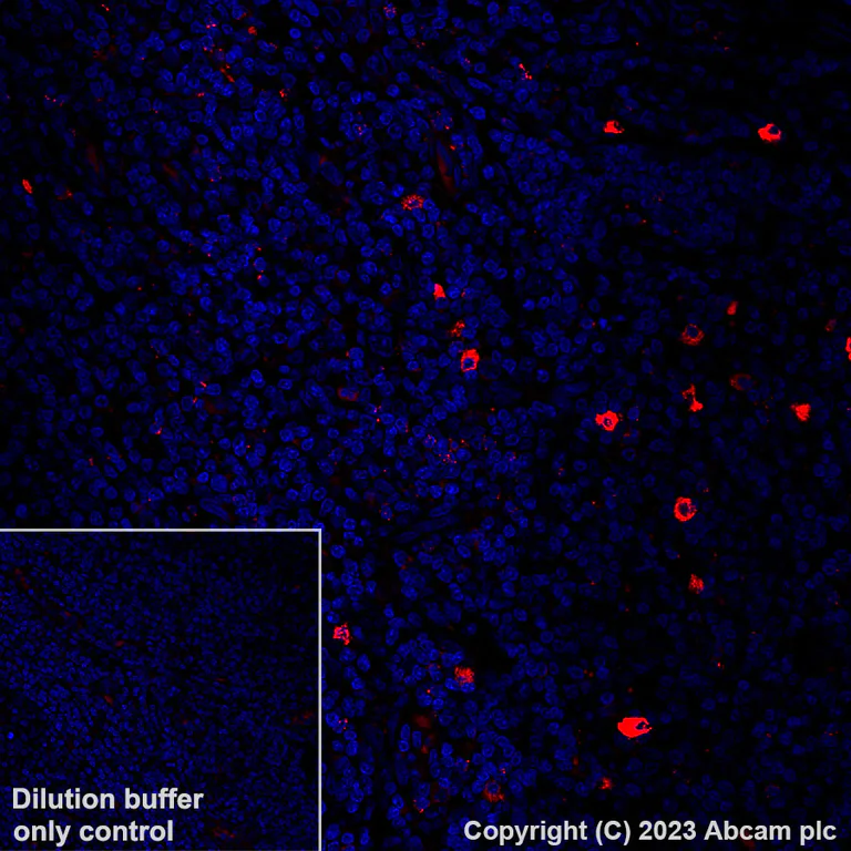 Immunohistochemistry (Formalin/PFA-fixed paraffin-embedded sections) - Alexa Fluor® 555 Anti-Granzyme B antibody [EPR22645-206] (AB308602)