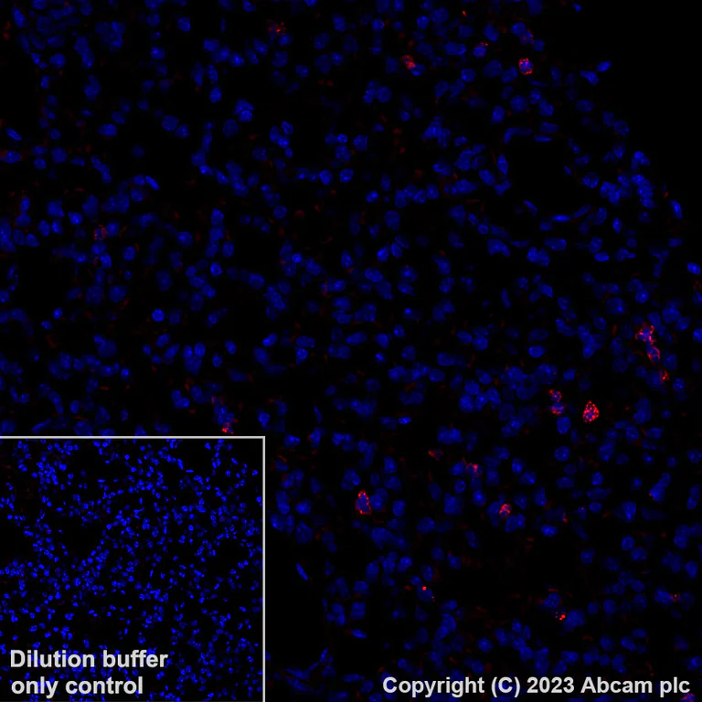 Immunohistochemistry (Formalin/PFA-fixed paraffin-embedded sections) - Alexa Fluor® 555 Anti-Granzyme B antibody [EPR22645-206] (AB308602)