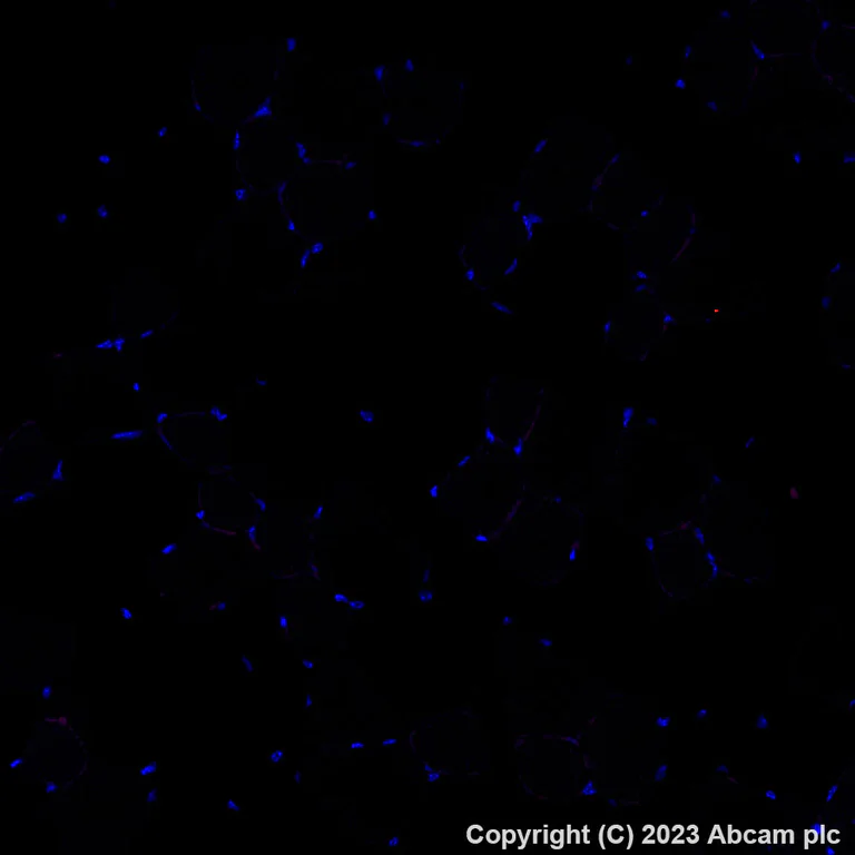 Immunohistochemistry (Formalin/PFA-fixed paraffin-embedded sections) - Alexa Fluor® 555 Anti-Granzyme B antibody [EPR22645-206] (AB308602)