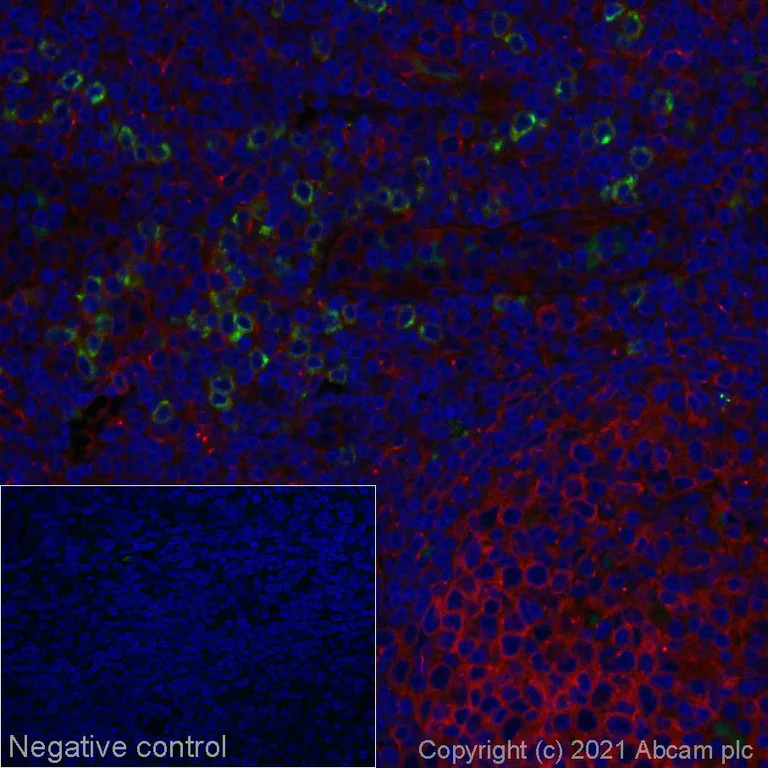 Immunohistochemistry (Formalin/PFA-fixed paraffin-embedded sections) - Alexa Fluor® 555 Anti-Granzyme B antibody [EPR8260] (AB280851)