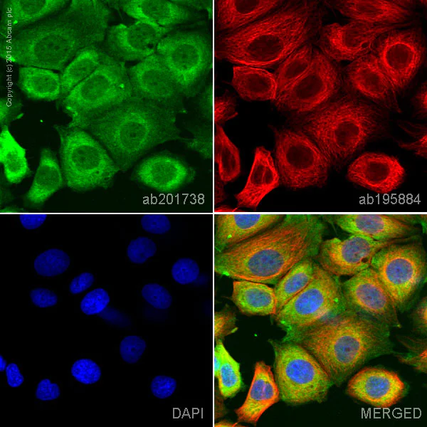 Immunocytochemistry/ Immunofluorescence - Alexa Fluor® 555 Anti-GSK3 beta antibody [Y174] (AB201738)