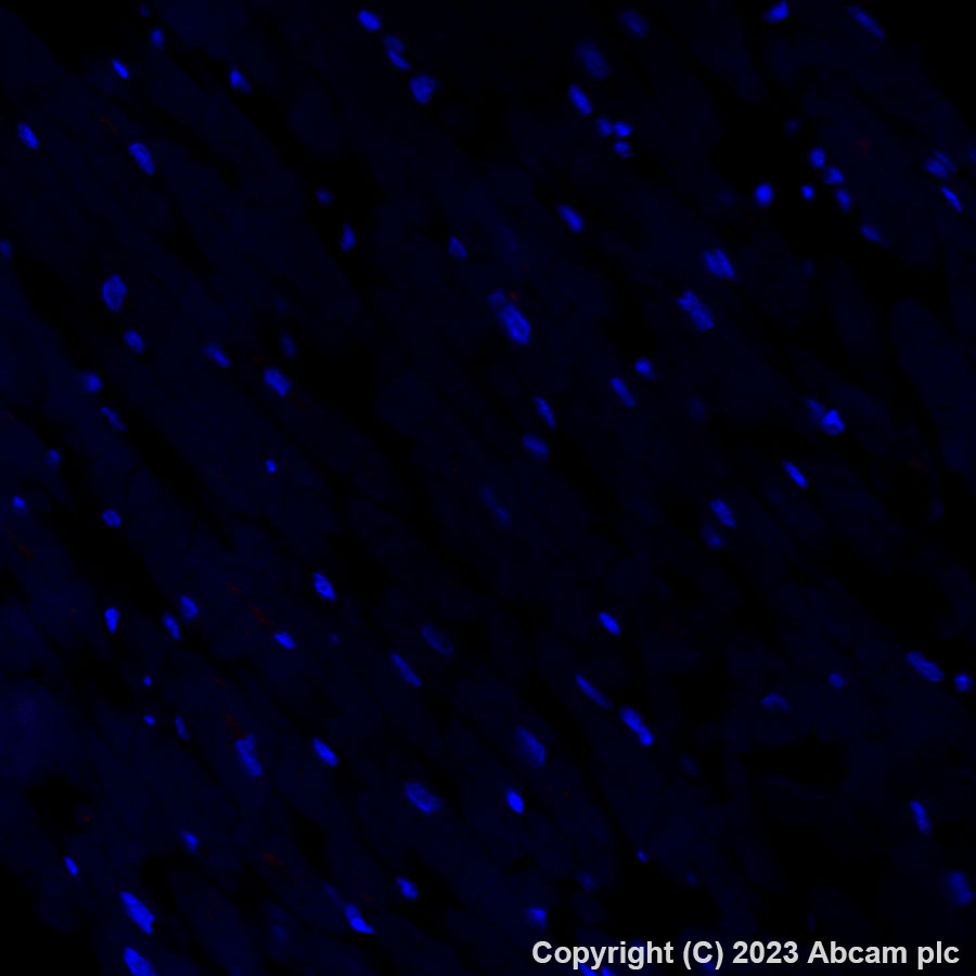 Immunohistochemistry (Formalin/PFA-fixed paraffin-embedded sections) - Alexa Fluor® 555 Anti-HLA Class 1 ABC antibody [EPR22172] (AB314336)